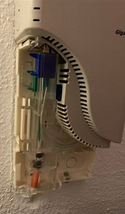 glasvezel